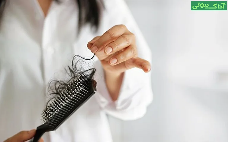 عوامل اصلی ریزش مو در بانوان
