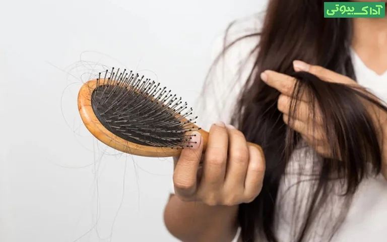 علل اصلی ریزش مو در زنان