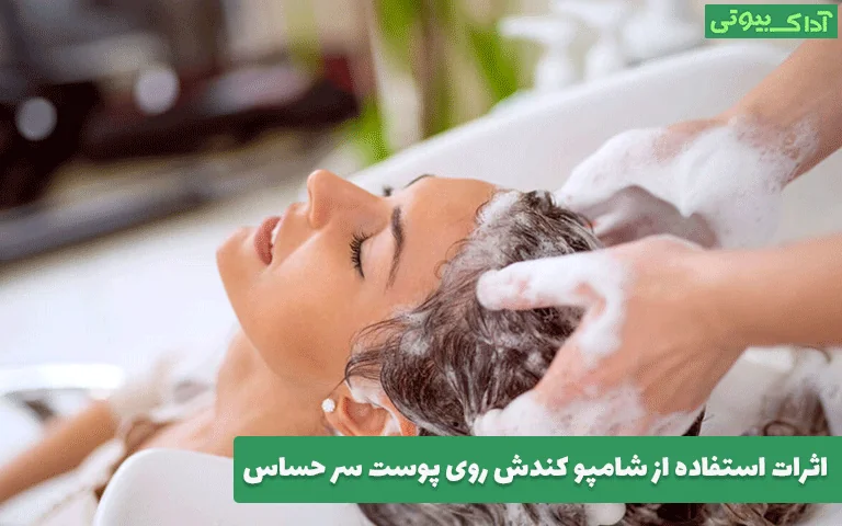 اثرات استفاده از شامپو کندش روی پوست سر حساس