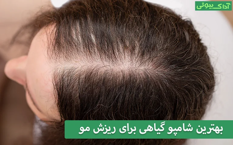 بهترین شامپو گیاهی برای ریزش مو