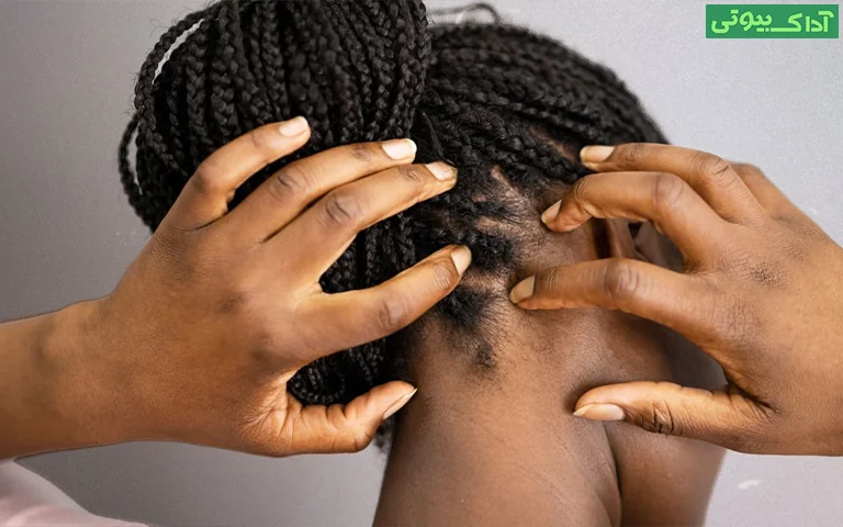 چرا پوست سر ما به مراقبت ضدباکتریایی نیاز دارد؟